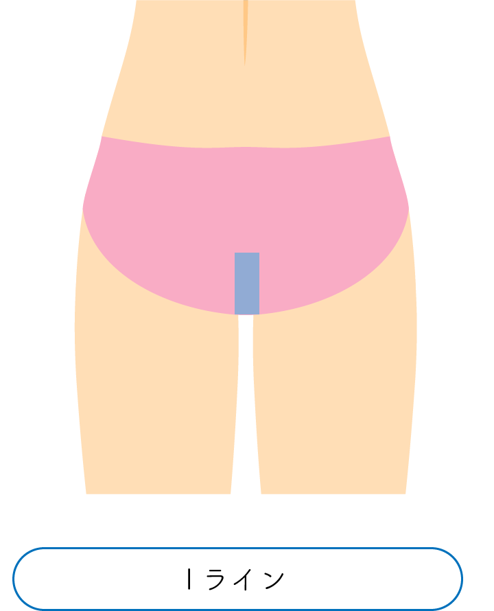 Iライン