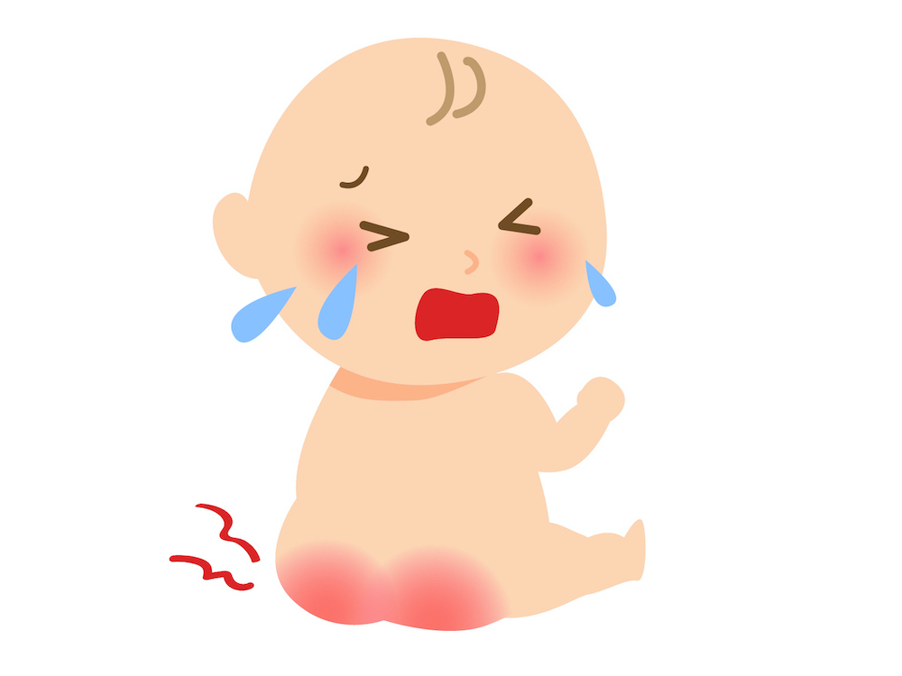 オムツかぶれ