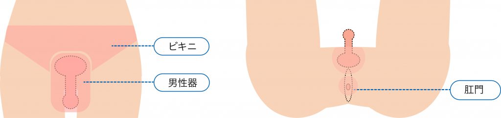 男性陰部脱毛